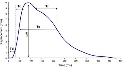 Evaluation of Calf Muscular Function During the Recovery Phase After the Repair of an <mark class="highlighted">Achilles Tendon Rupture</mark>